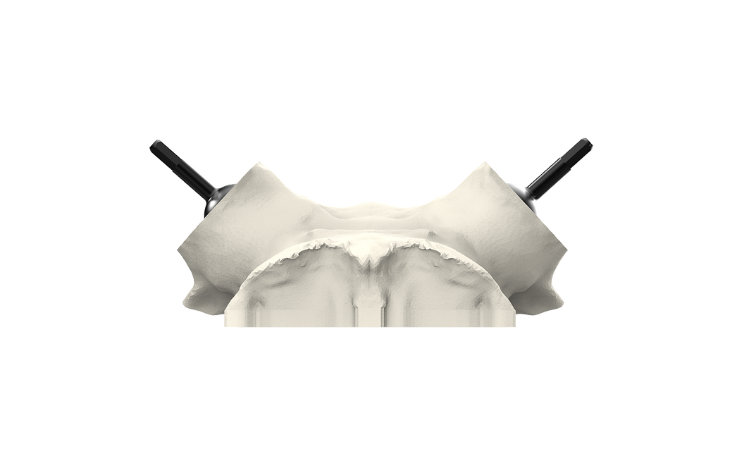 Universal Whitetail Skull Plate